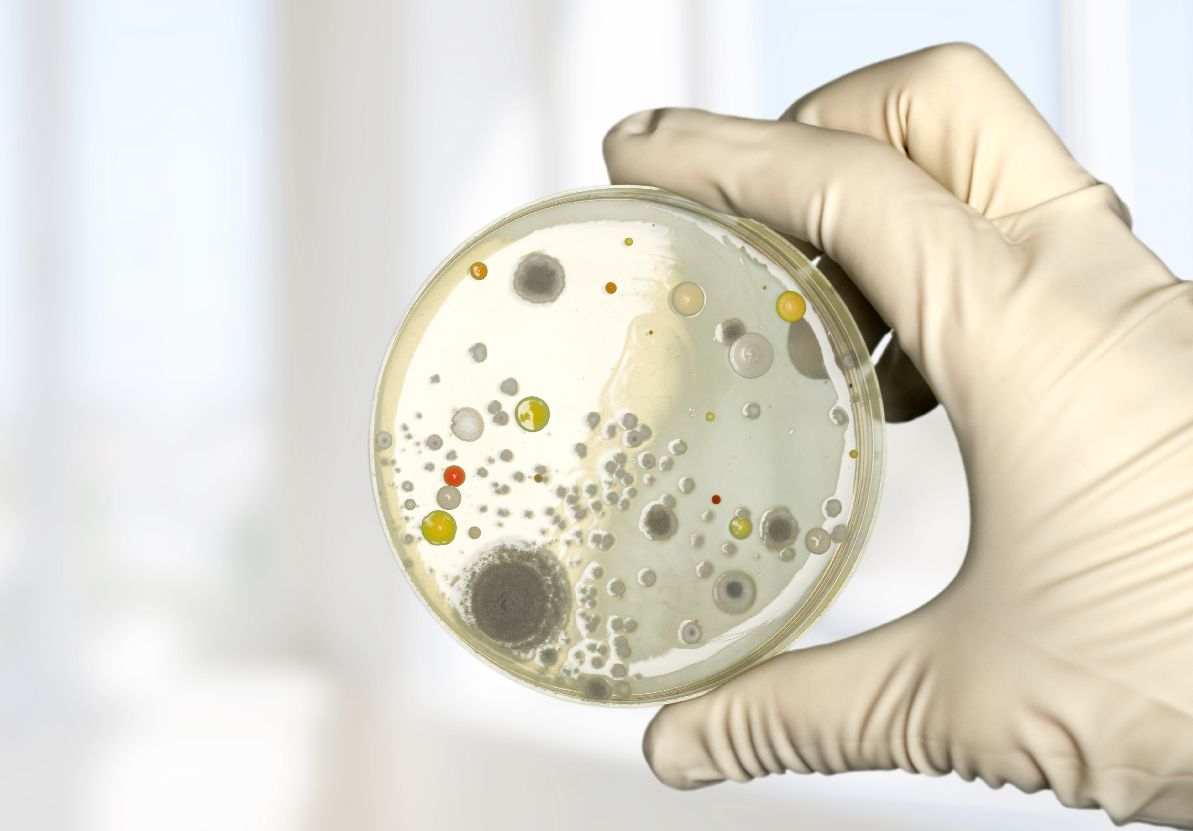 Premium Mold Toxicity